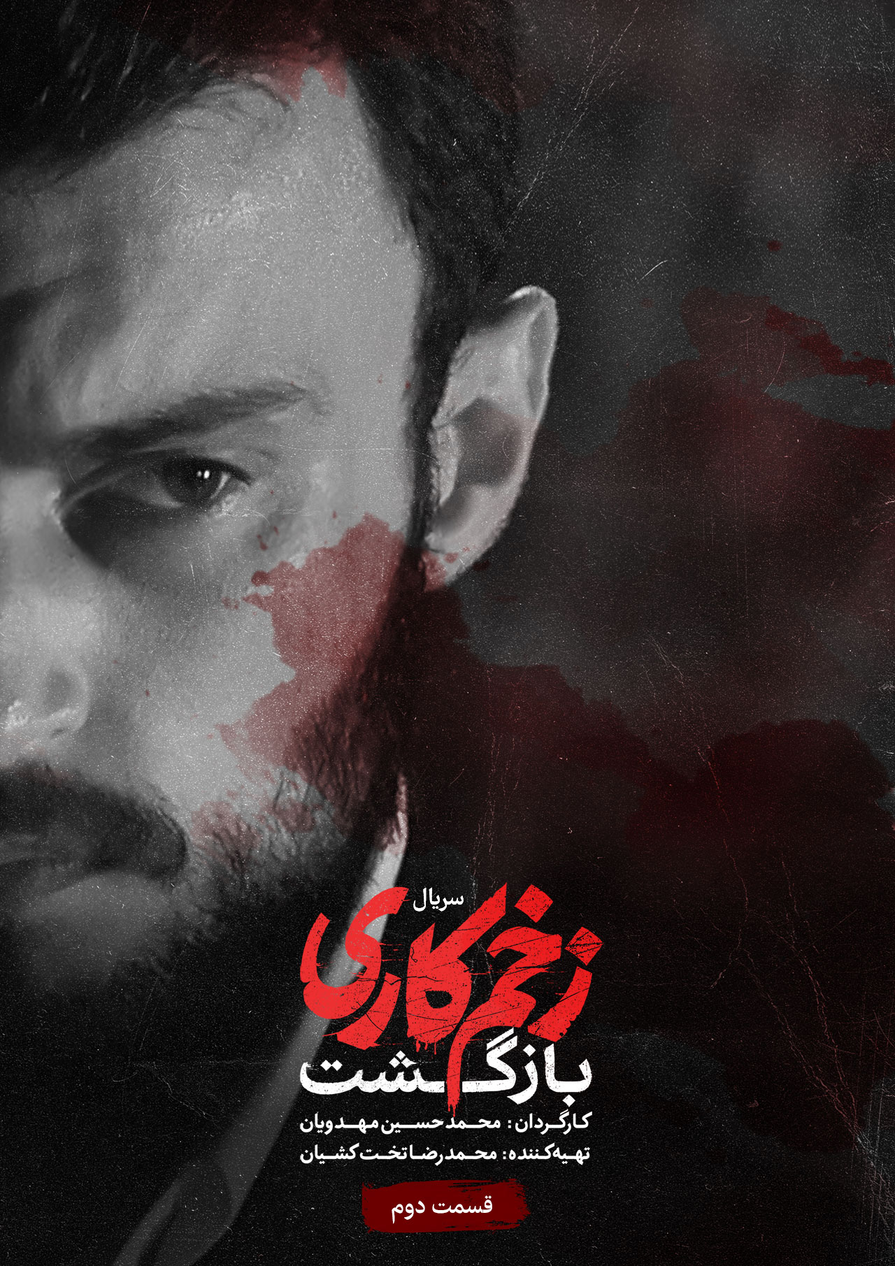 پوستر قسمت دوم فصل دوم زخم کاری